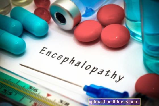 Encefalopatía hipertensiva: causas, síntomas, tratamiento.