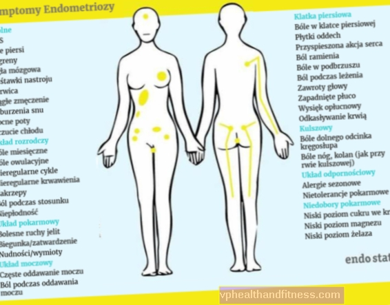 Endometriosis: síntomas, diagnóstico, tratamiento de la endometriosis