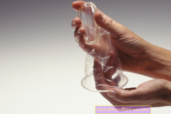Femidom je ženský kondom - dozvíte se o výhodách a nevýhodách