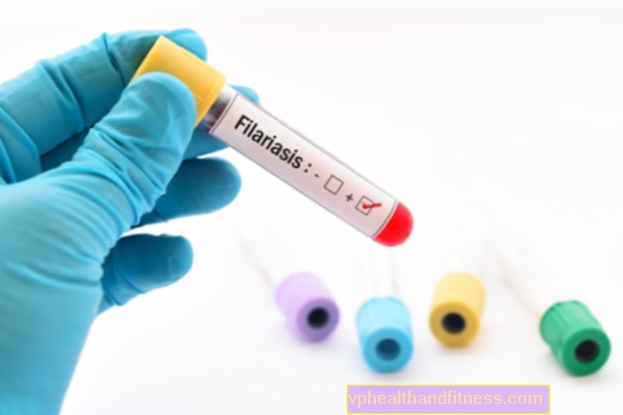 Filariasis: causas, tipos, síntomas, tratamiento