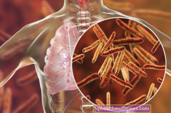 Tuberculosis: síntomas, examen, tratamiento.