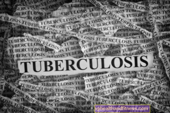 Tuberculosis miliar: causas, síntomas, tratamiento.