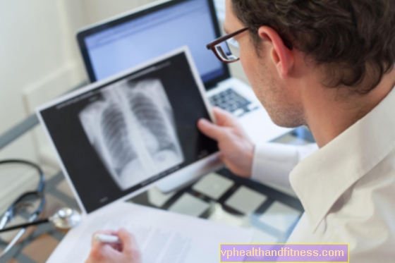 Tuberculosis pulmonar: causas, síntomas, tratamiento de la enfermedad pulmonar.