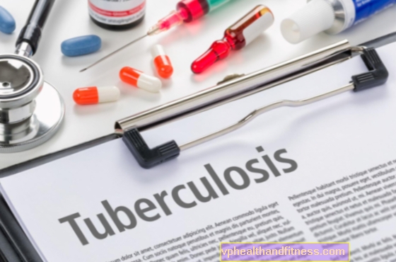 Tuberkulóza je obzvláště nebezpečná pro obyvatele města
