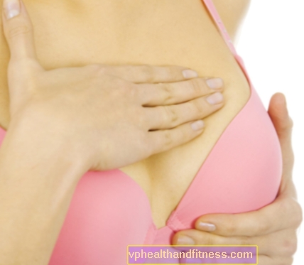 Brystmykose: årsager, symptomer, behandling