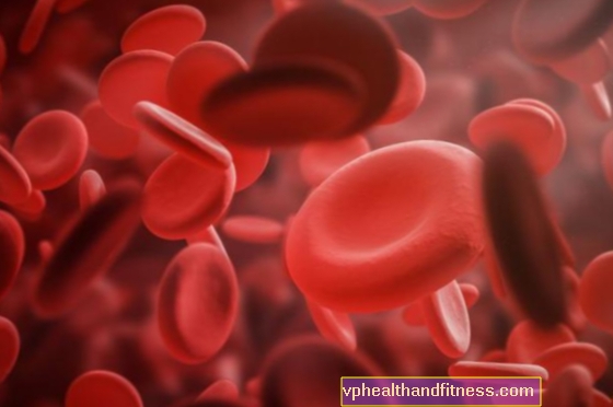 Hemofilie - dědičné onemocnění krve