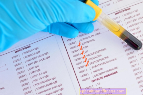 Hiperprolactinemia: causas, síntomas y tratamiento