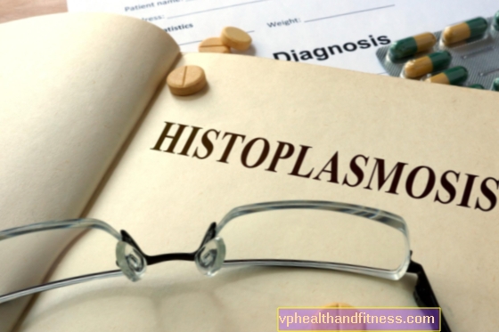 Histoplasmosis (enfermedad de Darling): causas, síntomas, tratamiento