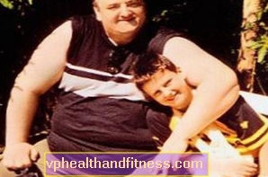 Прича о мршављењу са срећним крајем - Адриан Лукосзек: Изгубио сам 120 кг за годину дана
