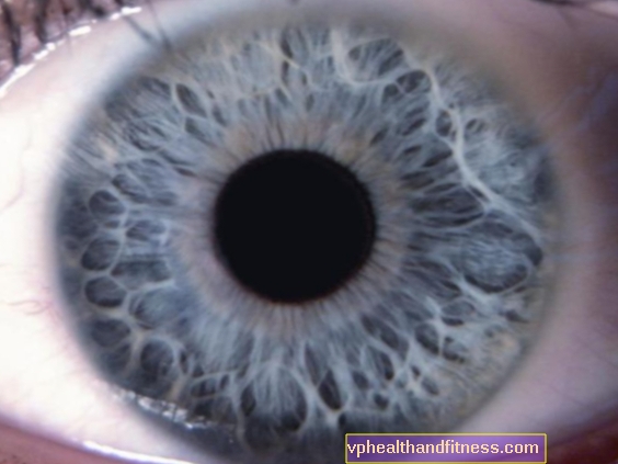 Iridología: ¿qué enfermedades se pueden leer en los ojos?