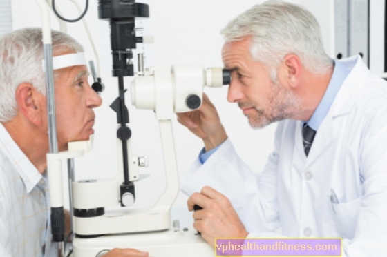 Glaucoma en el curso del síndrome de pseudoexfoliación (pseudoexfoliación, PEX) - glaucoma capsular