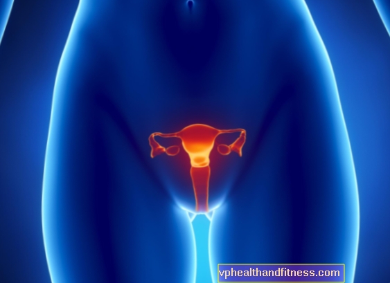 Der Hoden - ein Tumor des Eierstocks - führt bei einer Frau zum Auftreten männlicher Merkmale