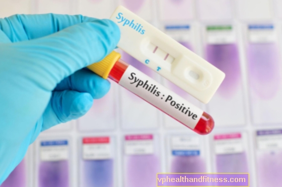 Syfilis i nervsystemet: symtom och behandling