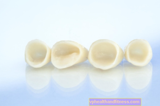 Tandkronor - en lösning för missfärgade och skadade tänder