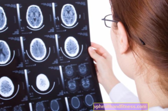 Intrakraniale hematomer, komplikasjoner etter hjerneskader