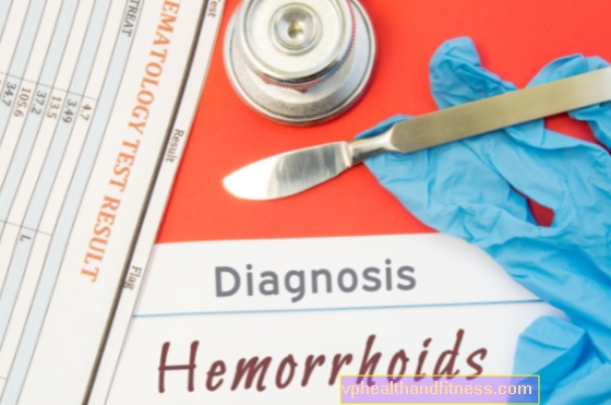 Zdravljenje hemoroidov. Kako učinkovito zdraviti hemoroide?