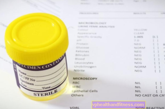 Leukotsüüdid uriinis - mida need tähendavad? Leukotsütuuria põhjused