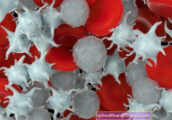 LYMPHOPENIA: pokles počtu lymfocytov v krvi. Príčiny, typy a liečba lymfopénie