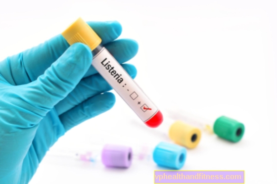 Listeria: una bacteria que causa una listeriosis grave. ¿Cuáles son los síntomas de la intoxicación por listeria?