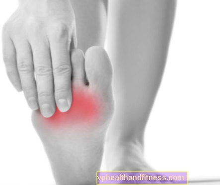 Metatarsalgia Morton: síntomas, causas, tratamiento del dolor de pie