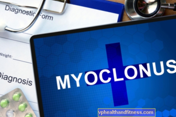 Myoklonus (ufrivillige bevegelser): årsaker, symptomer, behandling
