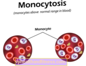 Monocitosis: causas. ¿Es peligroso el exceso de monocitos?