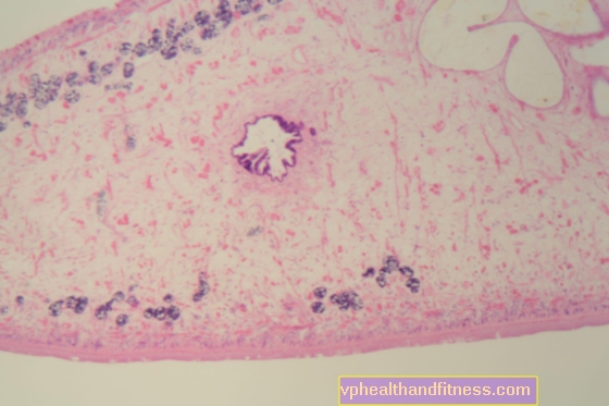 Pečeňová mykóza a fasciolóza - príznaky, liečba a diagnostika