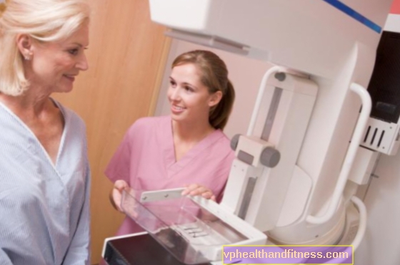 Vilka cancerformer drabbar kvinnor i Polen mest? RAPPORTERA