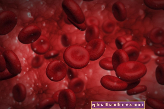 HIPERTENSIDAD (trombocitosis, alto recuento de plaquetas): causas, síntomas y tratamiento