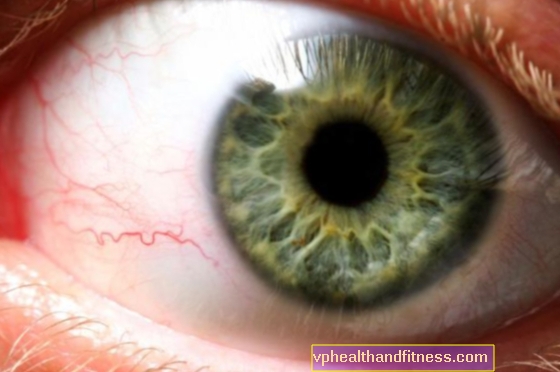 Pérdida repentina de la visión debido a glaucoma, inflamación ocular, sangrado, coagulación y embolia.