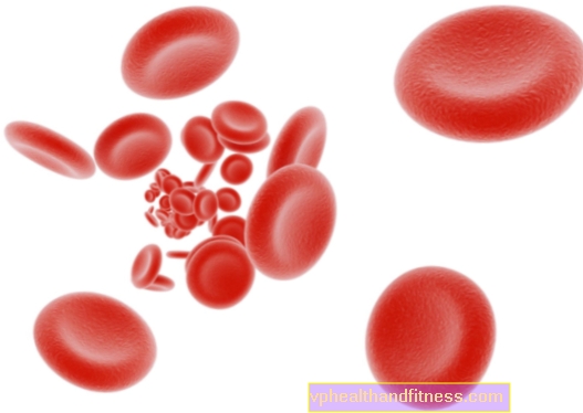 Paroksismaalinen yöllinen hemoglobinuria - syyt, oireet, vaikutukset ja komplikaatiot