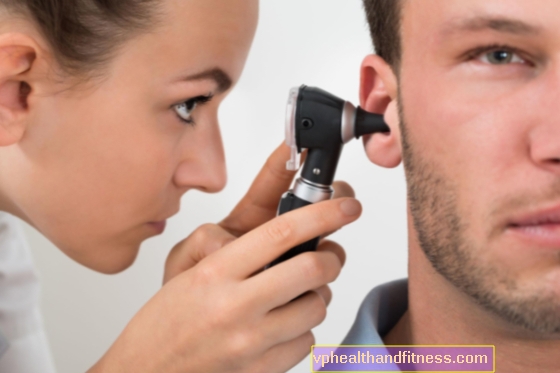 Neuroma del nervio auditivo (octavo): causas, síntomas y tratamiento