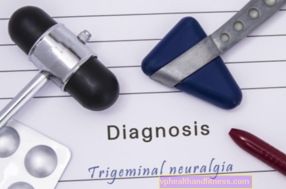 Neuralgia (neuralgia) del nervio trigémino: causas, síntomas, tratamiento