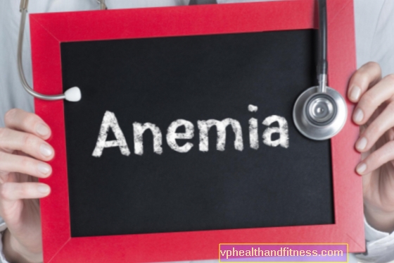 Megaloblastiline aneemia - põhjused, sümptomid ja ravi