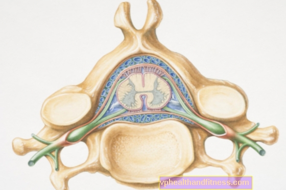 Tumores de la médula espinal: síntomas. ¿Cómo se reconocen los tumores de la médula espinal?