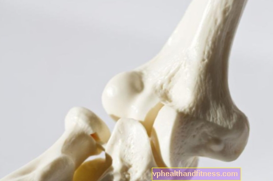 Çocuklarda osteoporoz: nedenleri ve tedavisi