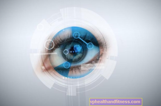 Ataque agudo de glaucoma: causas, síntomas, tratamiento.