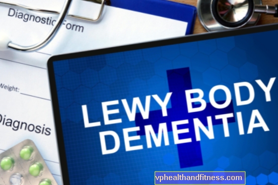 Деменция с тела на Леви - причини, симптоми и лечение