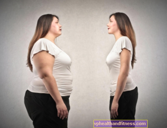 Затлъстяването - причини, лечение и последици