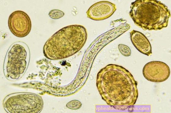 Pinworms lastel: sümptomid ja ravi