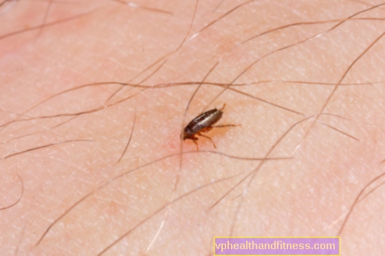Una pulga humana: cómo se ve, si la picadura es peligrosa y cómo combatirla