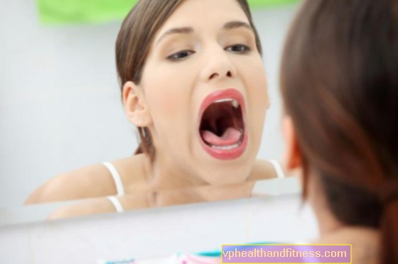 Rästas täiskasvanutel: suuõõne põhjused ja ravi