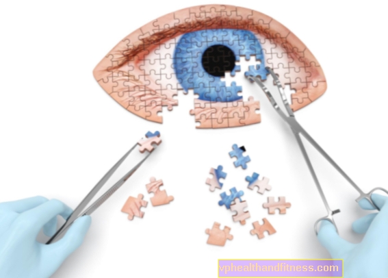 Пре операције катаракте, проверите да ли имате ЖУТУ ДЕНЕГЕРАЦИЈУ (АМД)