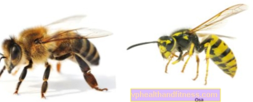 ABEJA - ¿Pican las abejas? ¿Qué aspecto tiene una abeja?