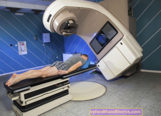 Radioterapija: kaip ji veikia? Šalutinis radioterapijos poveikis