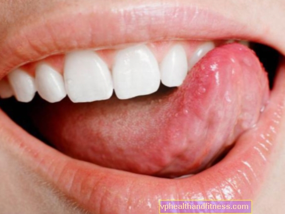 Cáncer de glándulas salivales: el riesgo de que ocurra aumenta con la edad