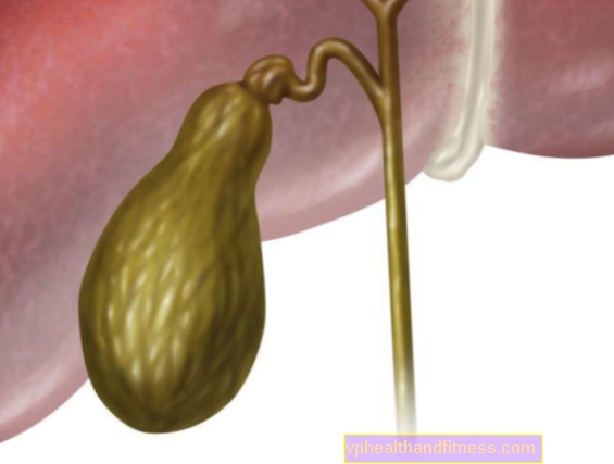 Cáncer de vesícula biliar: causas, síntomas, tratamiento y pronóstico