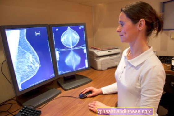 Tipos de cáncer de mama. El tratamiento depende del tipo de cáncer de mama