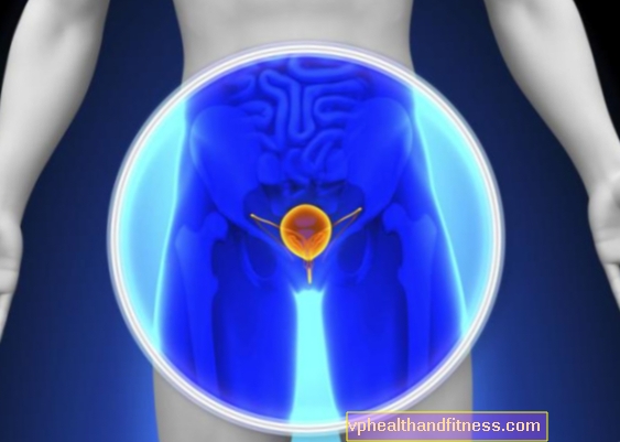 Urinblære i urinblæren: årsager, symptomer, behandling