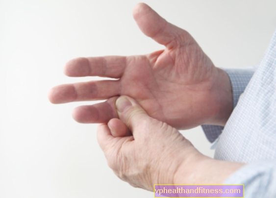 Artritis reumatoide: remedios para la AR